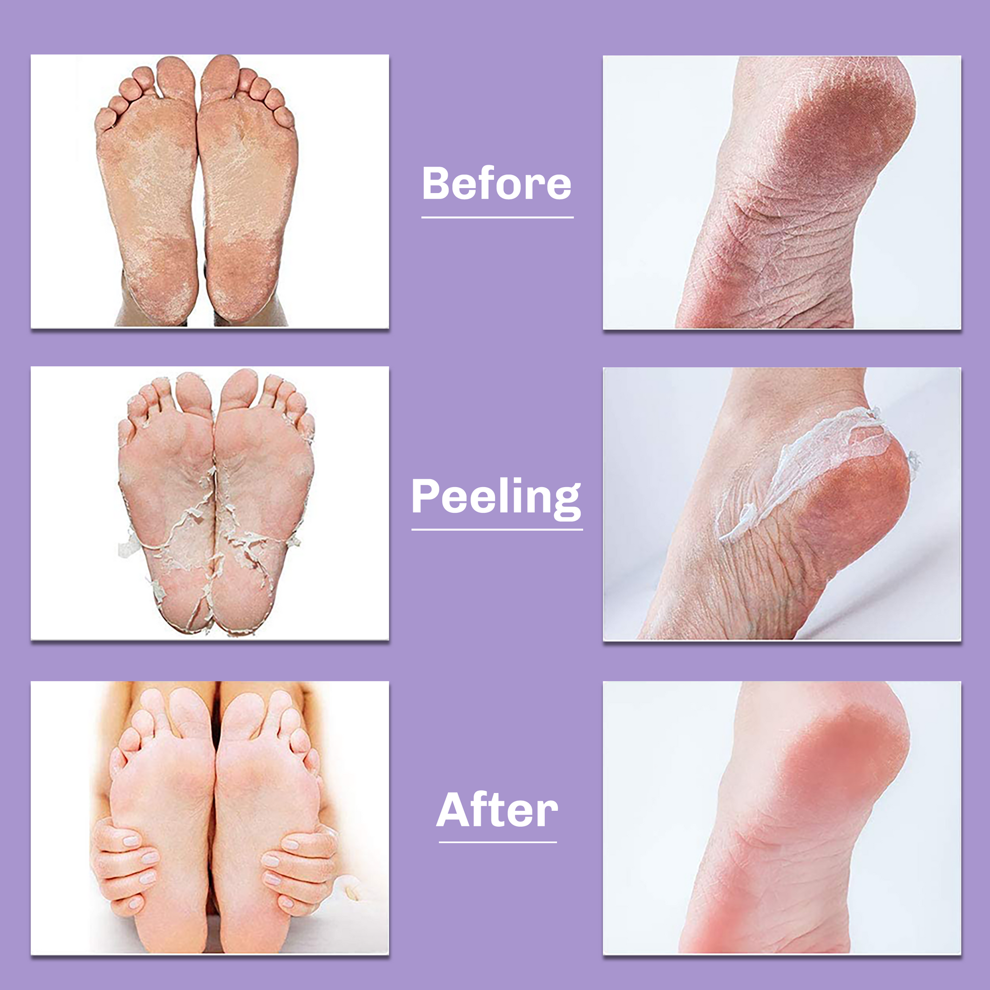 Foot Peeling Mask