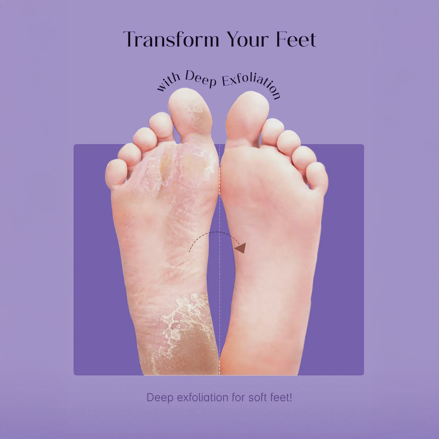 Foot Peeling Mask
