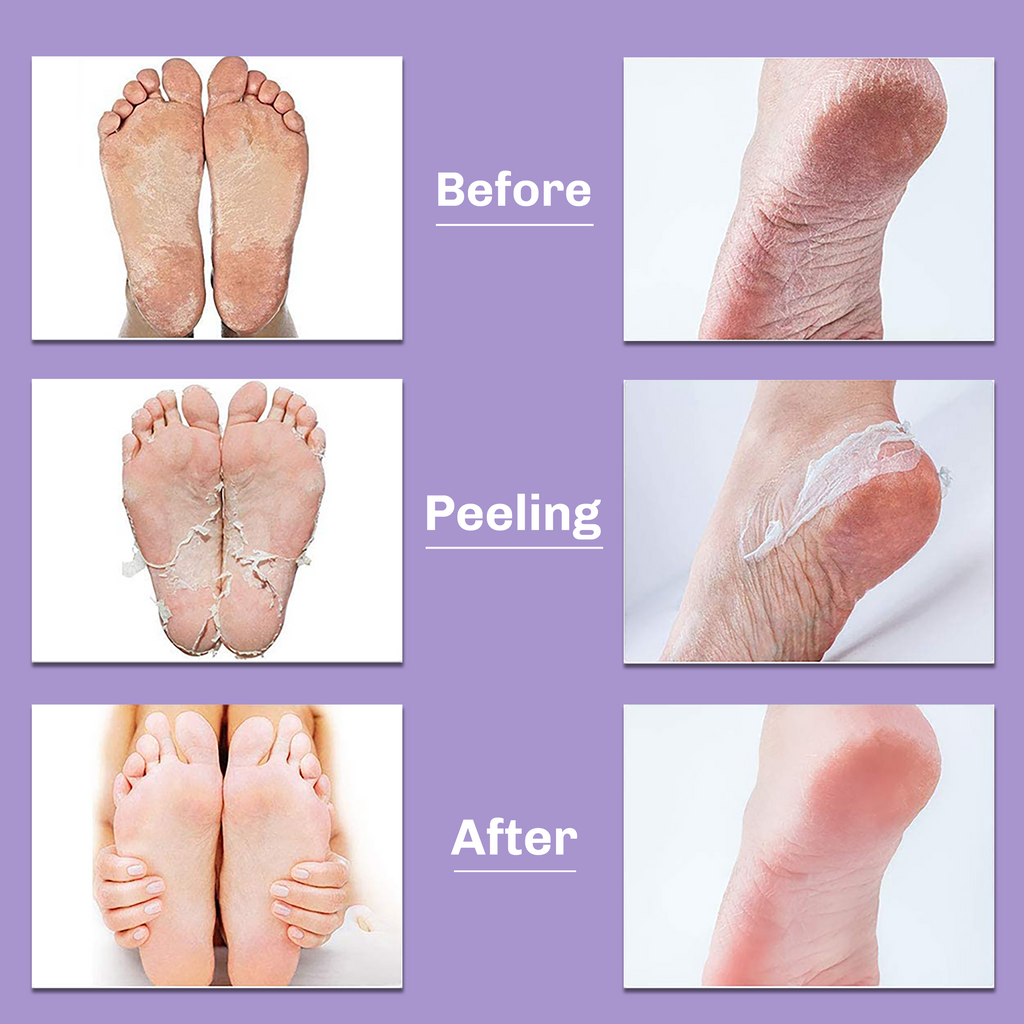 Foot Peeling Mask